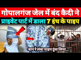 गोपालगंज जेल में कैदी ने खुद के प्राइवेट पार्ट में ठूंस लिया प्लास्टिक पाइप-2024